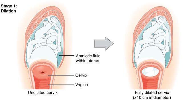 1st stage of labor