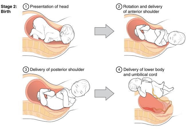 2nd stage of labor explained