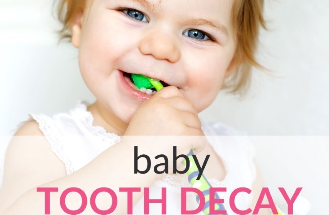 baby tooth decay