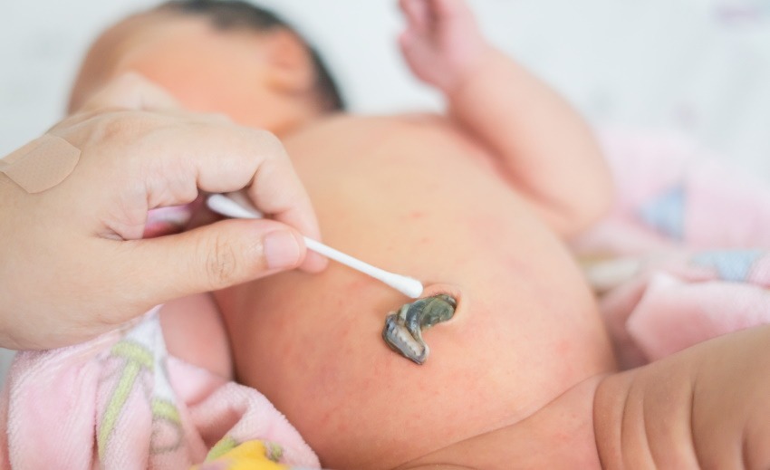 how to clean the umbilical cord stump