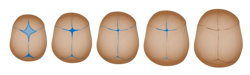 the closure of the fontanel of newborn