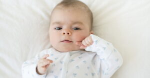 Read more about the article How to Get Rid of Baby Acne: What All Parents Should Know