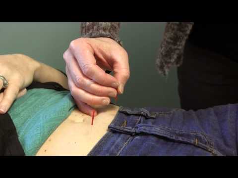 Acupuncture treatment for infertility