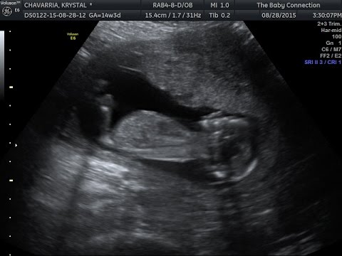 GENDER REVEAL &amp; ULTRASOUND @ 14 WEEKS 3 DAYS!!!